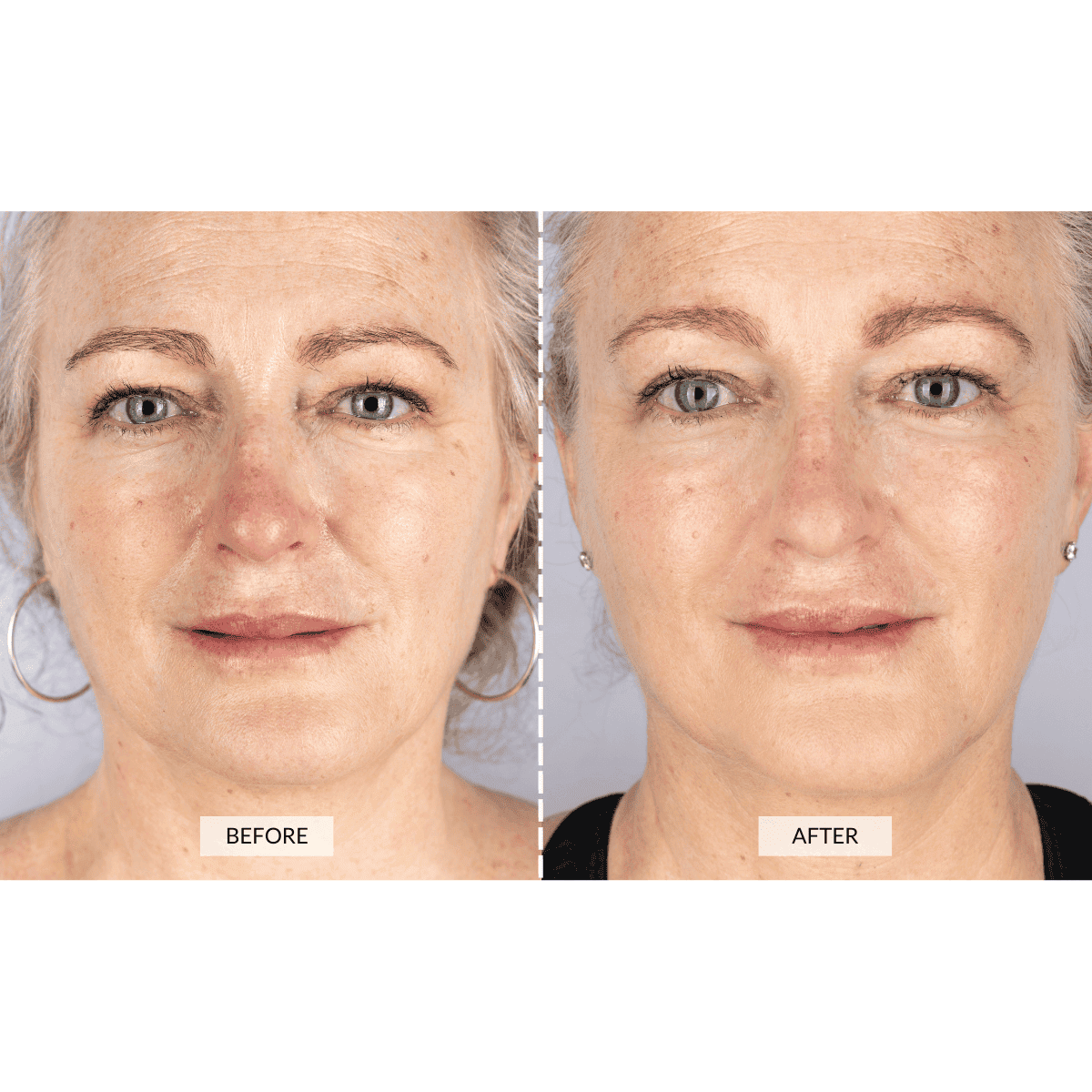Silver Series 1 LED mask by CurrentBody Skin shown on a model, featuring a sleek silver design for facial skin treatment.