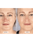 Silver Series 1 LED mask by CurrentBody Skin shown on a model, featuring a sleek silver design for facial skin treatment.