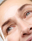 CurrentBody Skin RF Microneedling Treatment
