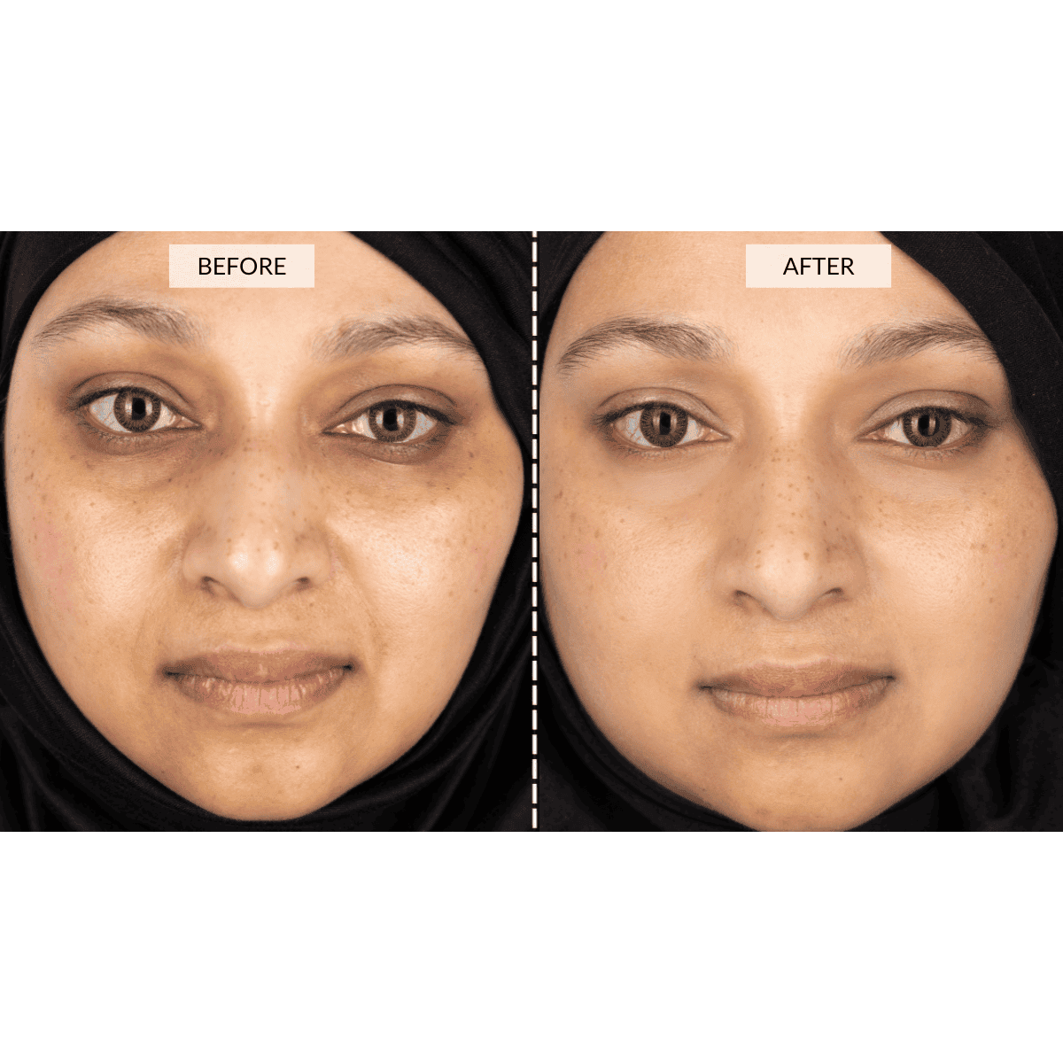 Silver Series 1 LED mask by CurrentBody Skin with adjustable straps and LED light panels for facial skincare.
