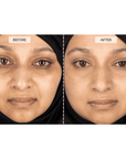 Silver Series 1 LED mask by CurrentBody Skin with adjustable straps and LED light panels for facial skincare.