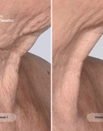 Before and after images showing the effects of the CurrentBody Skin The Ultimate Elevator on facial skin.