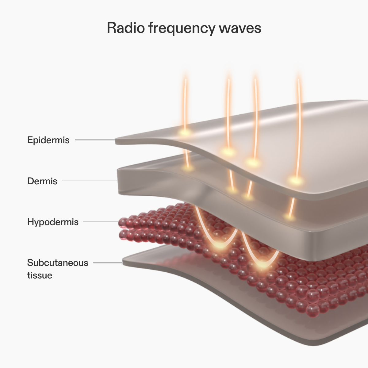 CurrentBody Skin RF skin tightening device emitting radio frequency waves for facial and body skin firming treatment.