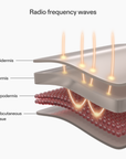 CurrentBody Skin RF skin tightening device emitting radio frequency waves for facial and body skin firming treatment.