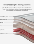 CurrentBody Skin Under Eye Microneedling Patches