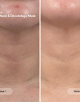 LED neck and décolletage mask by CurrentBody Skin, showing before and after results on skin appearance.