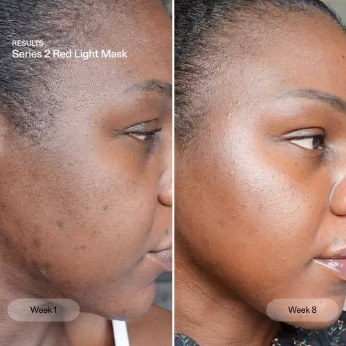 CurrentBody Skin The Skin Rewind Series 2 red light mask for even skin tone and skin rejuvenation.