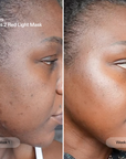 CurrentBody Skin The Skin Rewind Series 2 red light mask for even skin tone and skin rejuvenation.