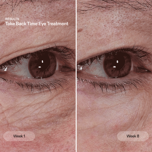 CurrentBody Skin The Skin Rewind eye treatment tube with Trinny London branding and applicator for reducing signs of aging around the eyes.