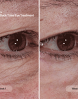 CurrentBody Skin The Skin Rewind eye treatment tube with Trinny London branding and applicator for reducing signs of aging around the eyes.