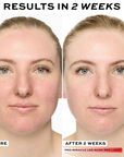 Revolution Pro Miracle LED Face Mask by LEDMASKCONCEPT showing a sleek, blue-lit facial treatment device with adjustable straps